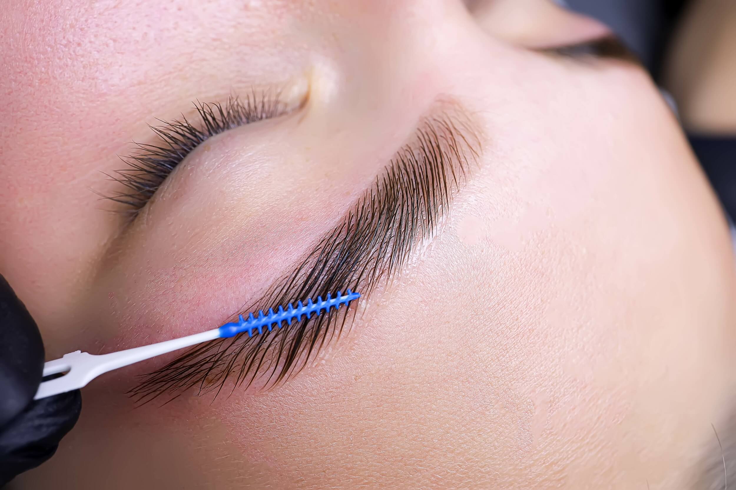 brow lift رفع الحواجب